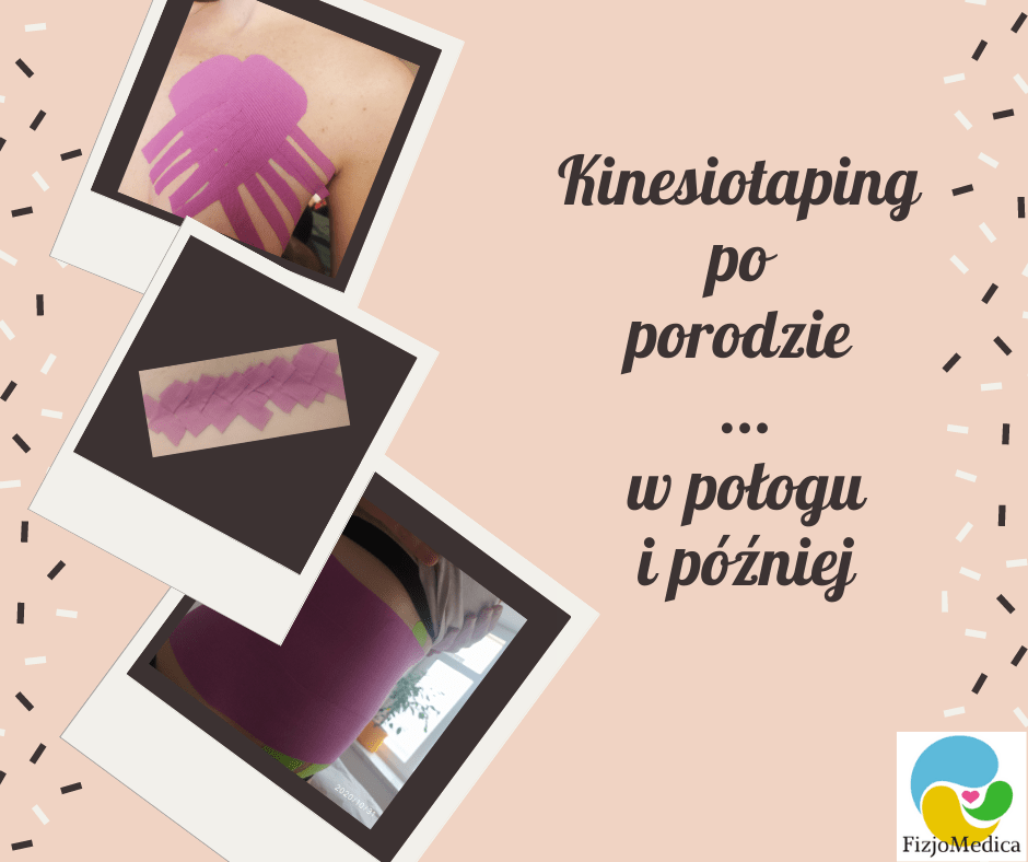 You are currently viewing Kinesiotaping po porodzie
